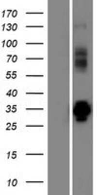 Western Blot: VPS37D Overexpression Lysate [NBP2-08464]