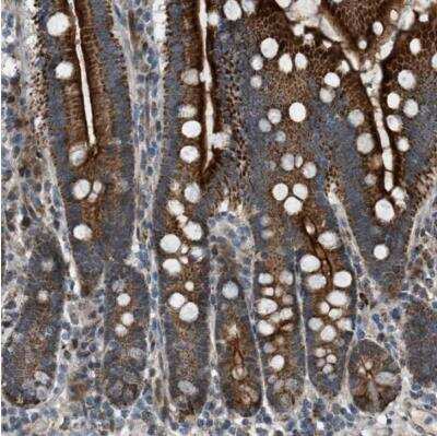 Immunohistochemistry-Paraffin: VPS41 Antibody [NBP1-81640]