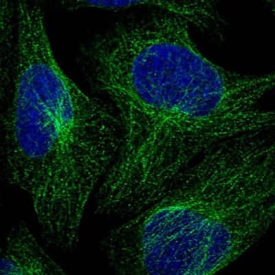 Immunocytochemistry/ Immunofluorescence: VPS45 Antibody [NBP1-81642]