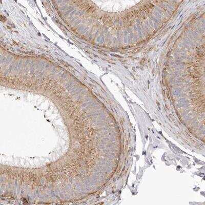 Immunohistochemistry: VPS45 Antibody [NBP1-81641]