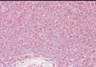 Immunohistochemistry-Paraffin: VPS45 Antibody [NB100-2431]
