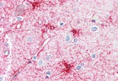 Immunohistochemistry-Paraffin: VPS45 Antibody [NB100-41372]