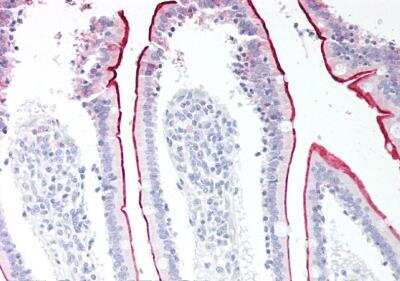Immunohistochemistry-Paraffin: VPS45 Antibody [NB100-41372]