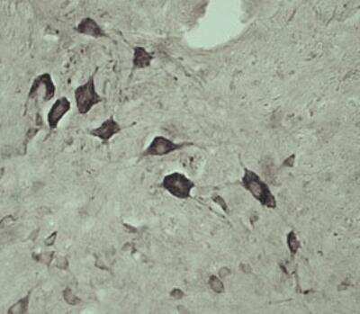 Immunohistochemistry-Paraffin: VPS45 Antibody - Azide and BSA Free [NB100-98931]