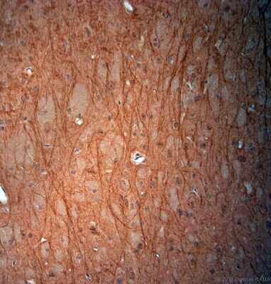 Immunohistochemistry-Paraffin: VPS45 Antibody - Azide and BSA Free [NB100-98931]