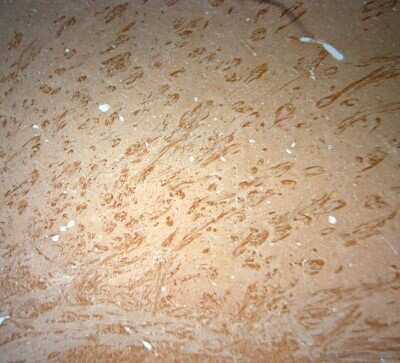 Immunohistochemistry-Paraffin: VPS45 Antibody - Azide and BSA Free [NB100-98931]