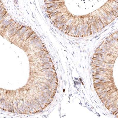 Immunohistochemistry-Paraffin: VPS45 Antibody [NBP1-81642]