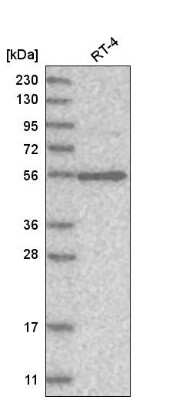 Western Blot: VPS45 Antibody [NBP1-81642]