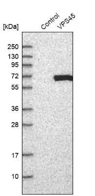 Western Blot: VPS45 Antibody [NBP1-81642]