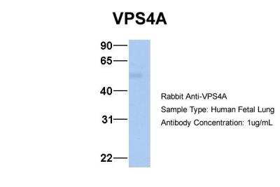 Western Blot: VPS4A Antibody [NBP1-54618]