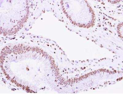 Immunohistochemistry-Paraffin: VPS4B Antibody [NBP2-20881]