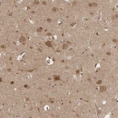Immunohistochemistry-Paraffin: VPS50 Antibody [NBP1-88012]