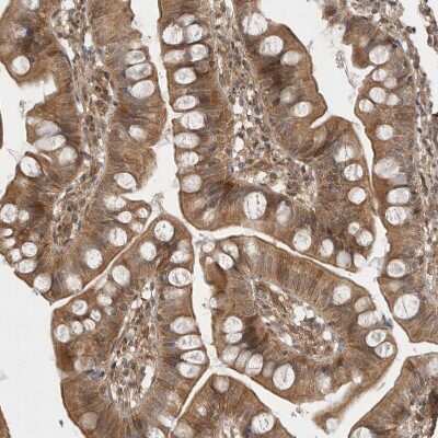 Immunohistochemistry-Paraffin: VPS50 Antibody [NBP1-88012]