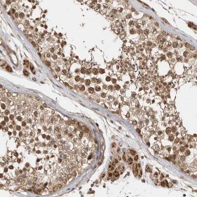 Immunohistochemistry-Paraffin: VPS50 Antibody [NBP1-88012]