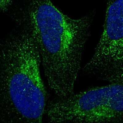 Immunocytochemistry/ Immunofluorescence: VPS53 Antibody [NBP1-83798]