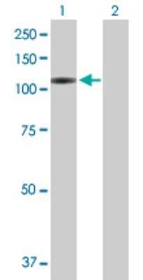 Western Blot: VPS54 Antibody [H00051542-B01P]
