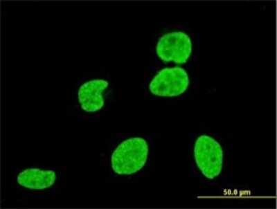 Immunocytochemistry/ Immunofluorescence: VPS8 Antibody (2C8) [H00023355-M01]