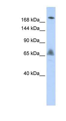 Western Blot: VPS8 Antibody [NBP1-55274]