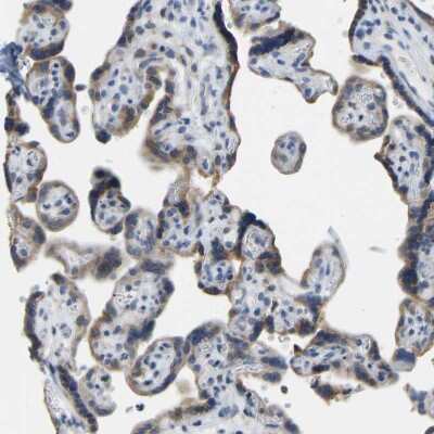 Immunohistochemistry: VRK1 Antibody [NBP1-89548]