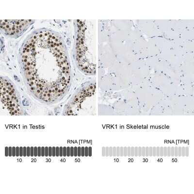 Immunohistochemistry-Paraffin: VRK1 Antibody [NBP1-89548]