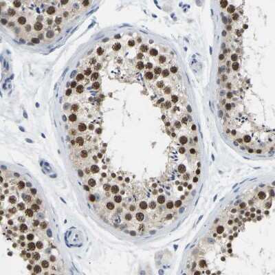 Immunohistochemistry-Paraffin: VRK1 Antibody [NBP1-89548]