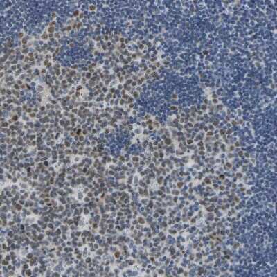 Immunohistochemistry-Paraffin: VRK1 Antibody [NBP1-89548]