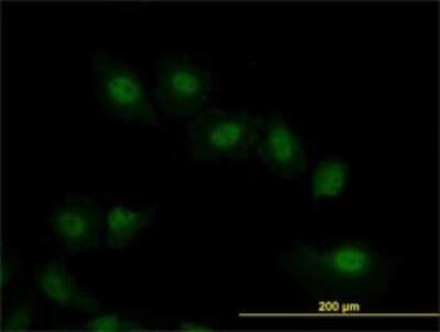 Immunocytochemistry/ Immunofluorescence: VRK2 Antibody (3B10) [H00007444-M01]