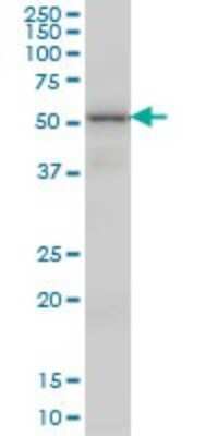 Western Blot: VRK2 Antibody (3B10) [H00007444-M01]