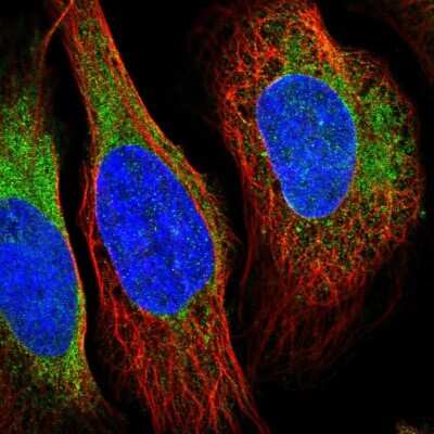 Immunocytochemistry/ Immunofluorescence: VRK2 Antibody [NBP2-48875]