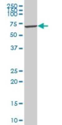 Western Blot: VRK2 Antibody [H00007444-B01P]