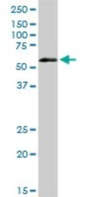 Western Blot: VRK2 Antibody [H00007444-D01P]