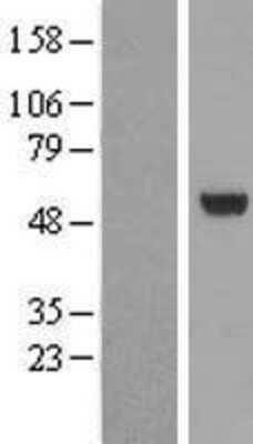 Western Blot: VRK3 Overexpression Lysate [NBP2-07047]