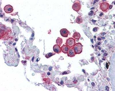 Immunohistochemistry-Paraffin: VRL1 Antibody [NBP1-32096]