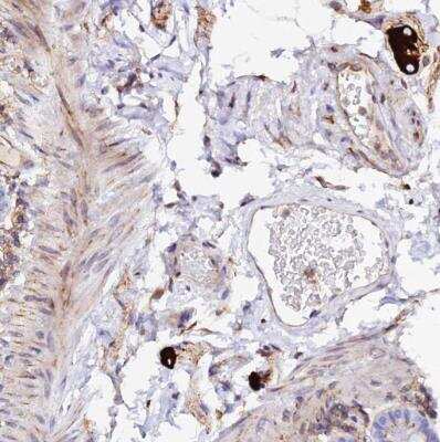 Immunohistochemistry-Paraffin: VRL1 Antibody [NBP1-92576]