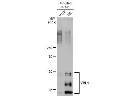 Western Blot: VRL1 Antibody [NBP1-32096]