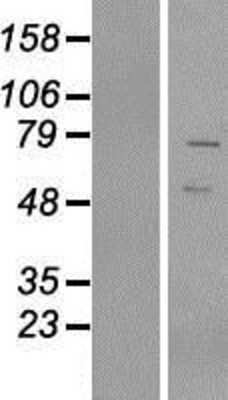 Western Blot: VRTN Overexpression Lysate [NBP2-06846]