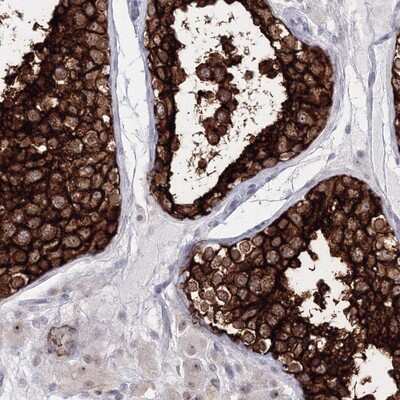 Immunohistochemistry-Paraffin: VSIG1 Antibody [NBP1-81072]