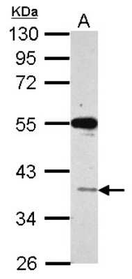 Western Blot: VSIG1 Antibody [NBP2-20883]