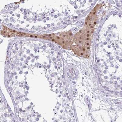 Immunohistochemistry-Paraffin: VSIG10L Antibody [NBP2-32542]