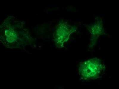 Immunocytochemistry/ Immunofluorescence: VSIG2 Antibody (OTI2D8) [NBP2-03376]