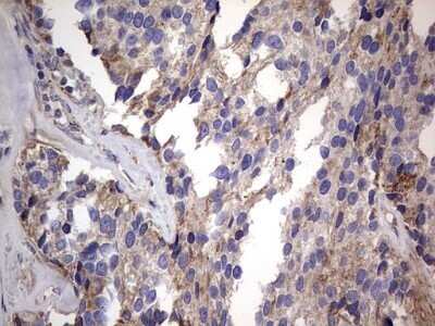 Immunohistochemistry: VSIG3/IGSF11 Antibody (OTI2H1) - Azide and BSA Free [NBP2-74861]