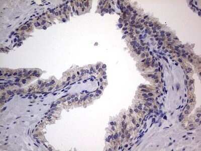 Immunohistochemistry: VSIG3/IGSF11 Antibody (OTI2H1) - Azide and BSA Free [NBP2-74861]
