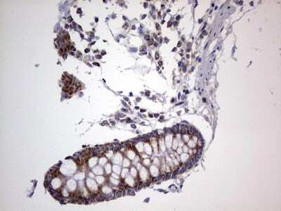 Immunohistochemistry: VSIG3/IGSF11 Antibody (OTI2H1) [NBP2-46046]