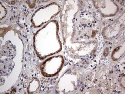 Immunohistochemistry: VSIG3/IGSF11 Antibody (OTI2H1) [NBP2-46046]