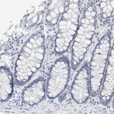 Immunohistochemistry-Paraffin: VSIG8 Antibody [NBP1-86415]