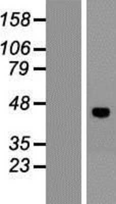 Western Blot: VSIG8 Overexpression Lysate [NBP2-08728]