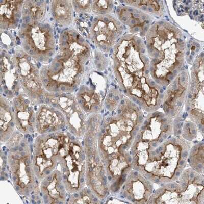 Immunohistochemistry-Paraffin: VSTM2A Antibody [NBP1-81114]