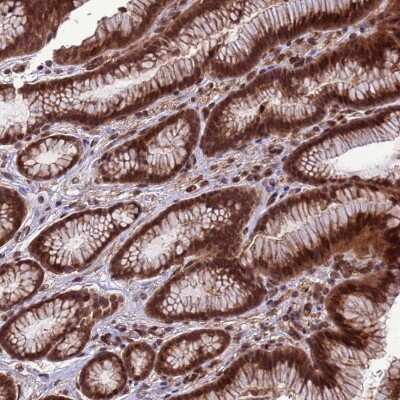 Immunohistochemistry-Paraffin: VSTM4 Antibody [NBP1-94127]