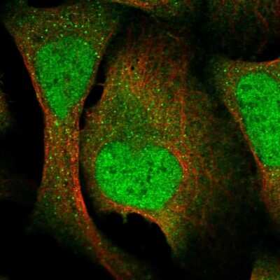 Immunocytochemistry/ Immunofluorescence: VTA1 Antibody [NBP2-58305]