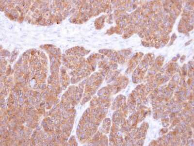 Immunohistochemistry-Paraffin: VTA1 Antibody [NBP1-32570]